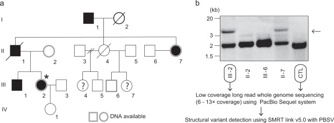 Fig 1. Pedigree of a family harboring pathogenic structural variations in SAMD12. (Mizuguchi et al., 2019)