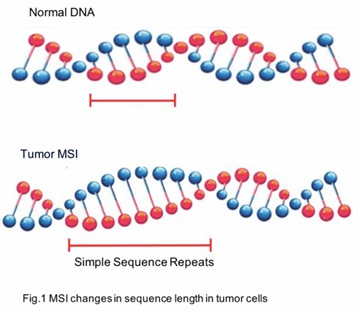 Fig.1 Changes in microsatellite length in tumor cells