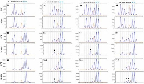 Figure 3. MSI detection in 12 fresh frozen MMR-deficient CRC samples (S1-S12) using HT17 microsatellite with LT-RPA and PCR. (Daunay et al., 2019)