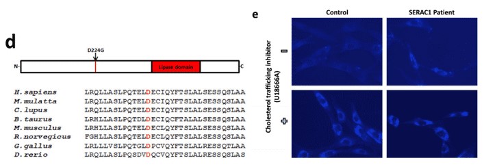 Figure 1. Localization of the D224 mutation across different species (d). Intracellular cholesterol transport in fibroblasts sourced from healthy individuals and SERAC1 patients. U1866A acts as a hindrance to cholesterol transport. (Rodríguez-García et al., 2016)